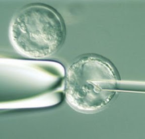 Celule