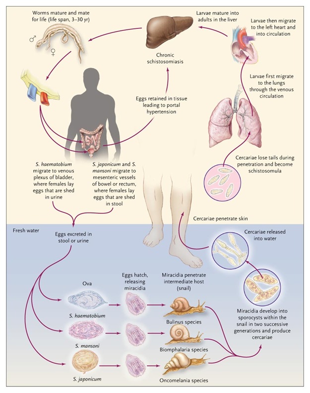 schistomiasis