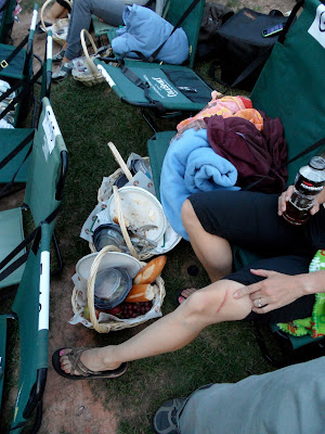One of the many mountain bike injuries, along with the gutted remains of some of the picnic baskets.