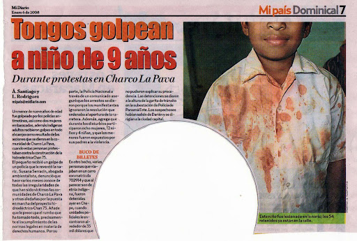 Niño golpeado por intervención de la Polic�a Nacional de Panamá en sus tierras Gnobes