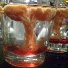 Brain Hemorrhage