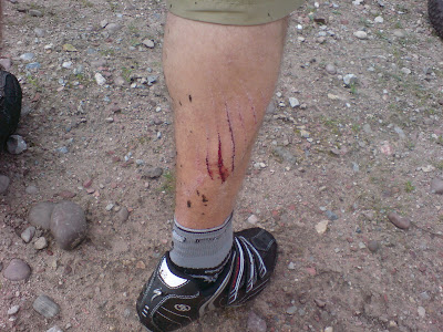 Another Ouch!