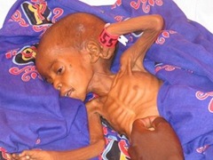 darfur_child_starving