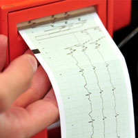 The Normal 12 Lead ECG
