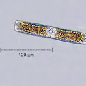 Diatom