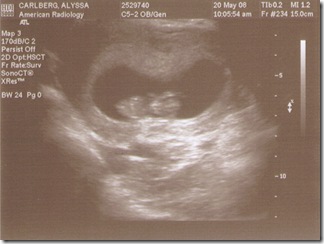 Ultrasound-2008-05-20