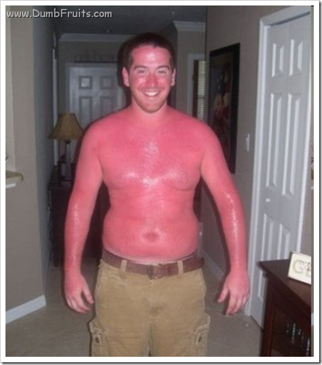 ultimate sun burn ever : incredible hulk red brother ultimate sun burn ever : incredible hulk red brother