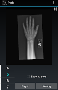 How to get Radiology Flashcards: Peds 1.4 apk for laptop