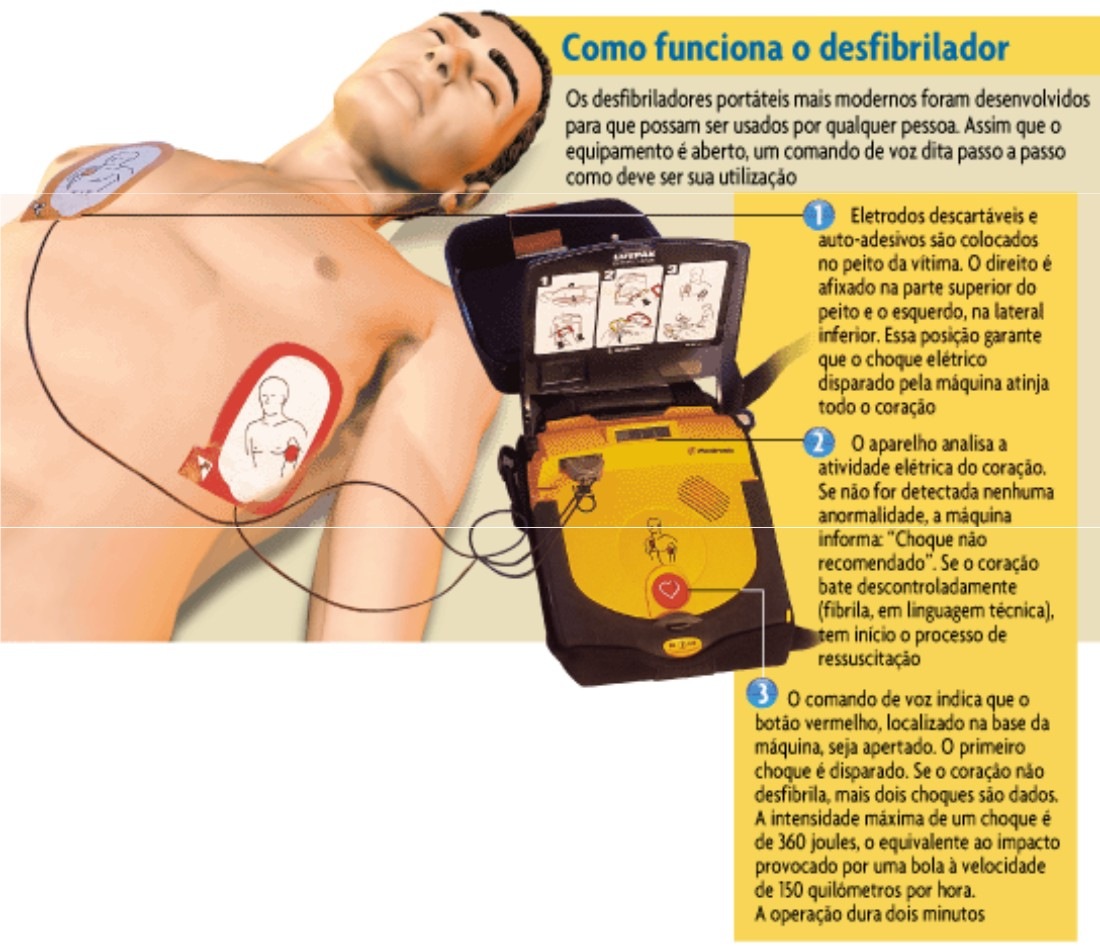 [desfibrilador10.jpg]