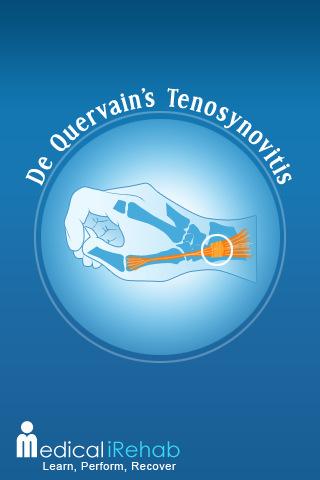 De Quervain's Tenosynovitis