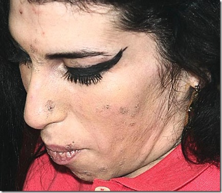 Amy Winehouse Drugs