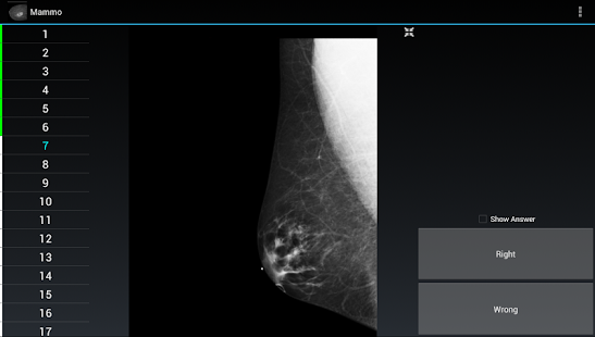 How to download Radiology Flashcards: Mammo 1.4 mod apk for bluestacks