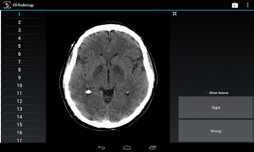 How to get Radiology Flashcards: ER 1.4 unlimited apk for bluestacks