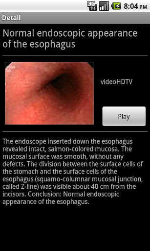 【免費醫療App】ENDO3®GASTRO - Lite-APP點子