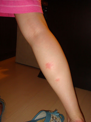 mosquito