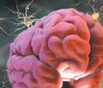neurologic-diseases