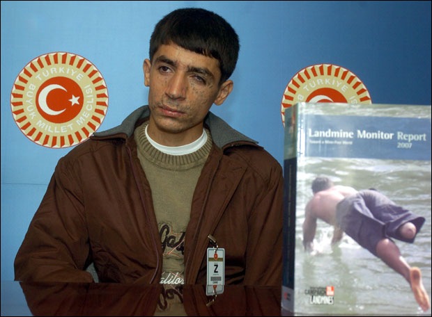 [May1n yüzünden sakat kalan Diyarbak1rl1 Nesim Öner[3].jpg]