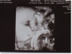 ultrasound1