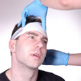 Classification and Assessment of People with Head Injuries