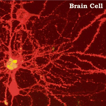 FireShot capture #18 - 'A Brain Cell is the Same as the Universe' - sprott_physics_wisc_edu_pickover_pc_brain-universe_html