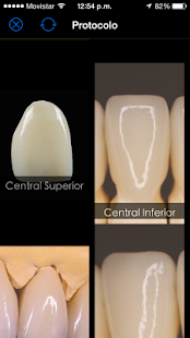 How to mod DentlApp 1.0 unlimited apk for laptop