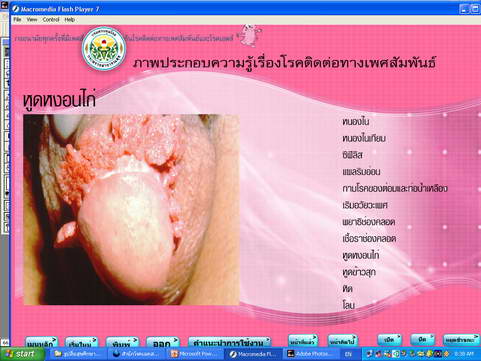 [photo mblog bonkalasin]