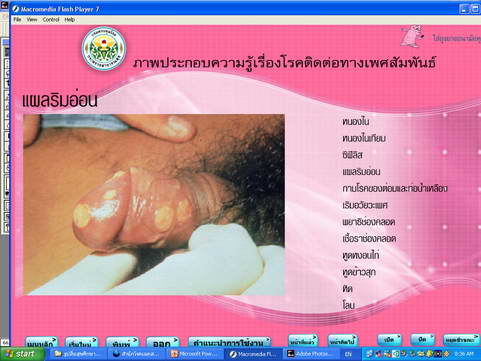 [photo mblog bonkalasin]