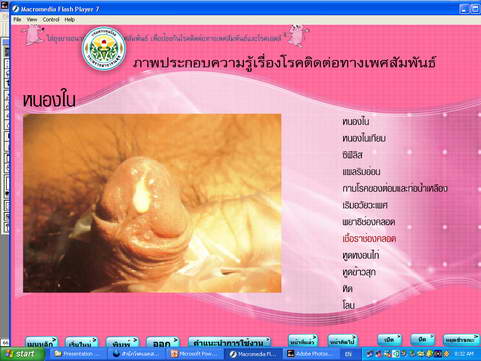 [photo mblog bonkalasin]