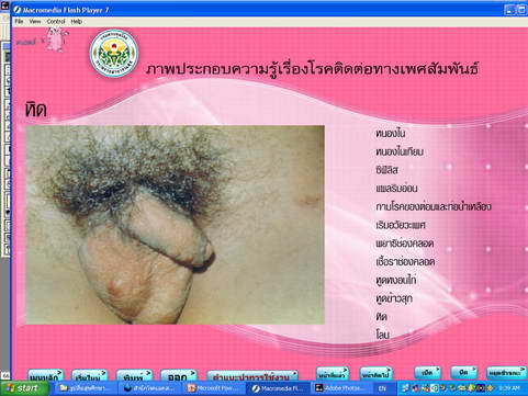 [photo mblog bonkalasin]