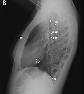 Radiografia Radiografia