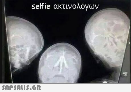 selfie ακτινολ0yuv 