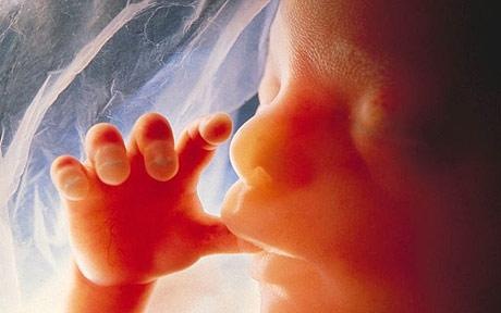 [baby-scan[3].jpg]