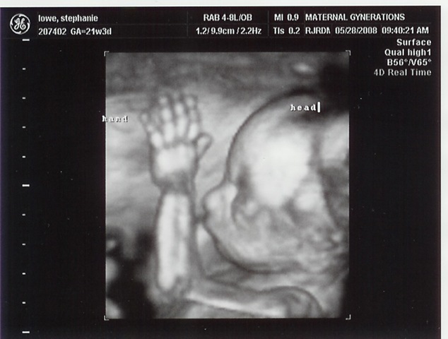 [Baby Brennan[2].jpg]