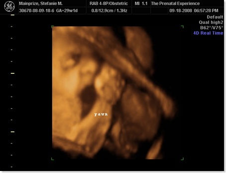 emilyultrasound 018