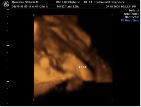 emilyultrasound 012