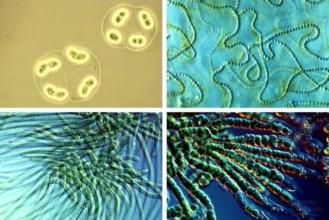 [Cyanobacteria8.jpg]
