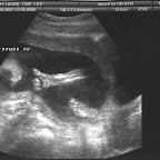 Kaden's Sonogram