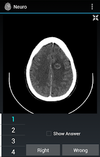 How to mod Radiology Flashcards: Neuro lastet apk for pc