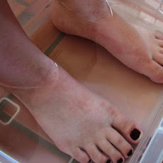 Foot Soak
