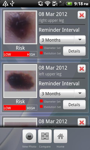 【免費醫療App】Doctor Mole - Skin cancer app-APP點子