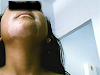 Vitiligo Manchas Blancas Nuevo Tratamiento