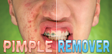 Pimple Remover APK