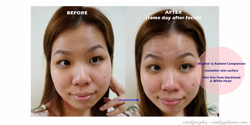 [cellnique%2520O2%2520derma%2520result%255B2%255D.jpg.webp]