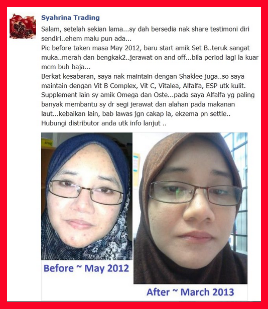 Image result for testimoni set kecantikan shaklee