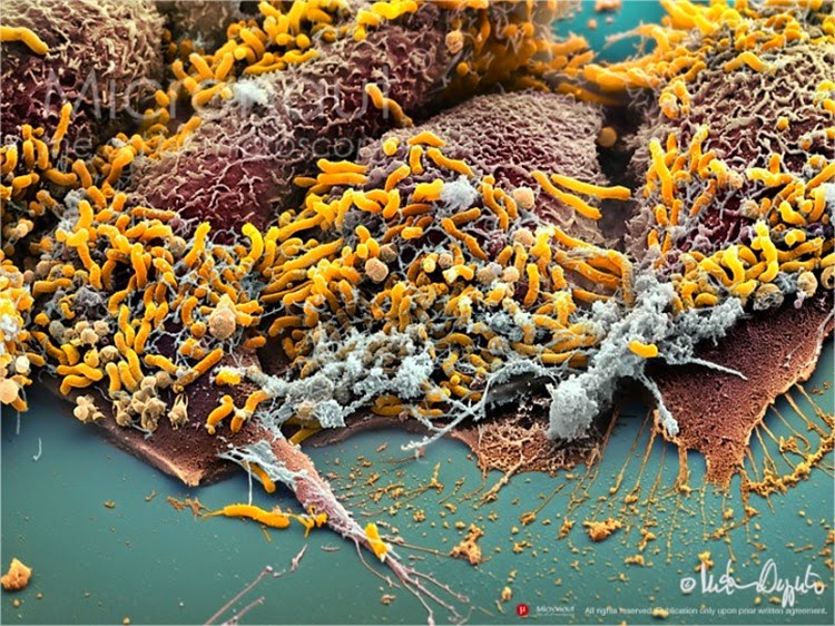 Helicobacter pylori (amarelo)