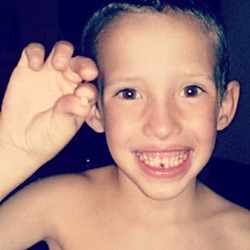 Lost Tooth, Hudson