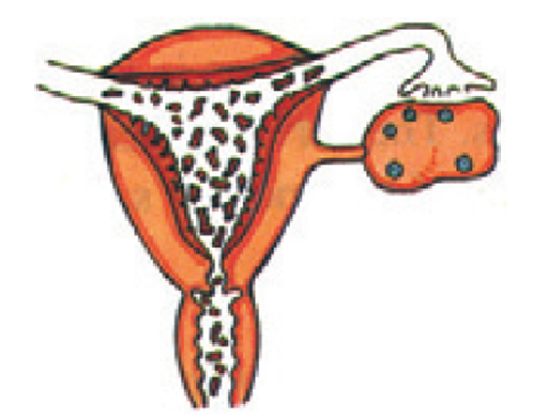 siklus menstruasi