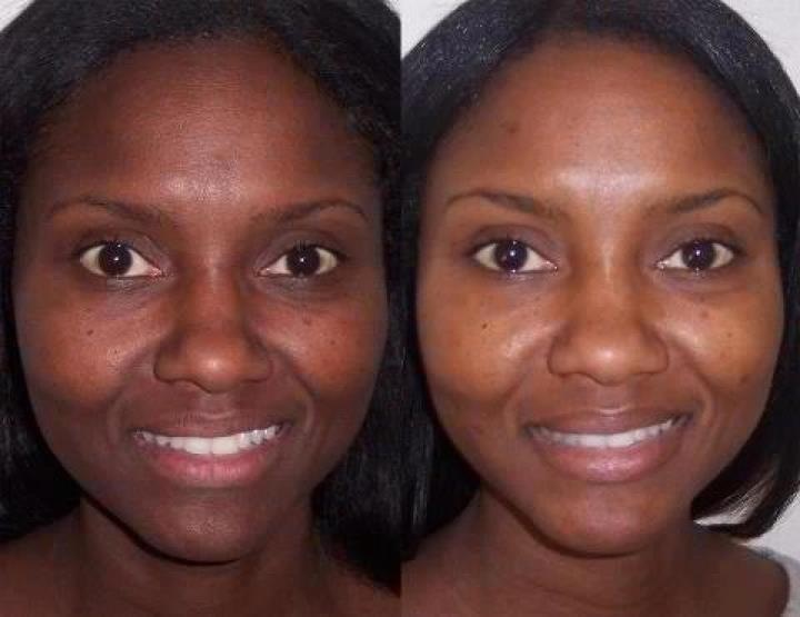 Best Eczema Treatments - eczema.net