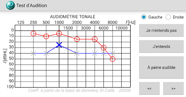  Test d'Audition – Vignette de la capture d'écran  