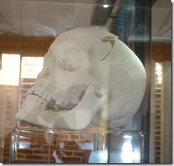 RIII 3d printed skull reconstruction